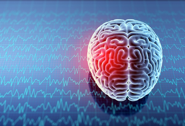 A 3D model of a human brain with a glowing red area on one side to represent a concussion, set against a blue background with digital wave patterns.