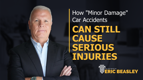 Minor Damage Car Accidents Can Still Cause Serious Injuries video thumbnail